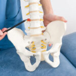 Hernia discal: qué es esta lesión vertebral, causas y tratamiento